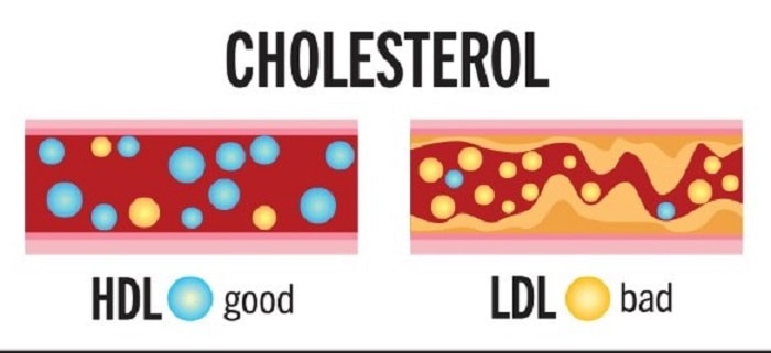 ldl cholestrol